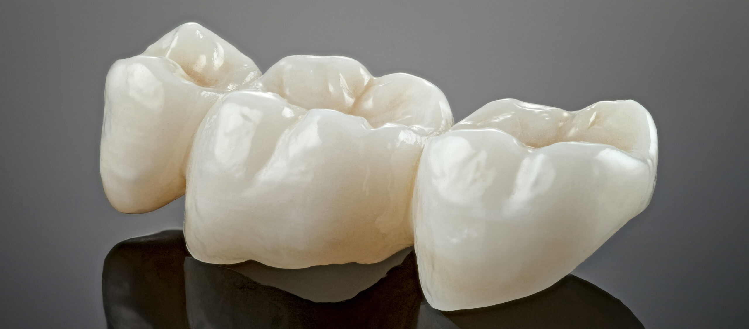 How Long Do Dental Crowns Last?