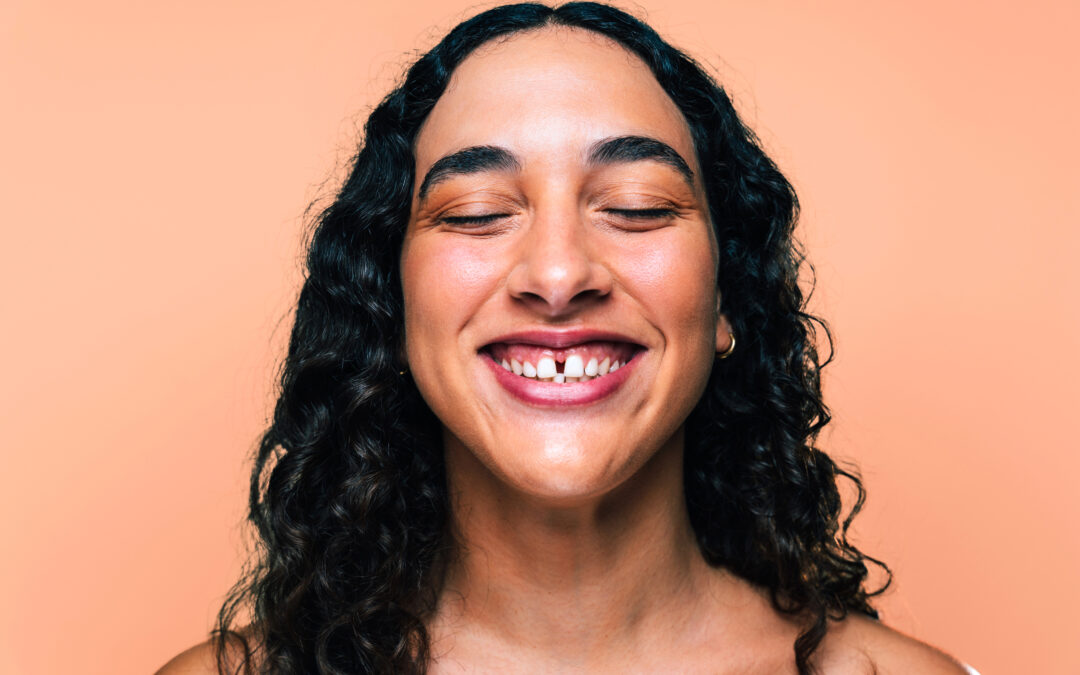 What Is Diastema Closure? A Friendly Guide to Fixing Tooth Gaps